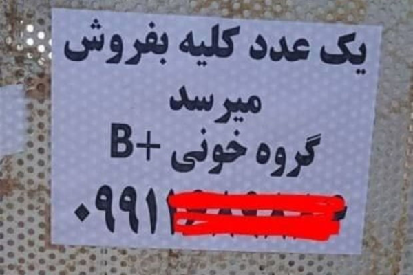 İranda çarəsiz insanlar böyrəklərini satır - FOTO
